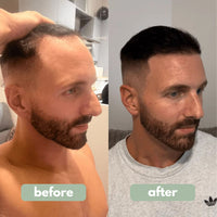 Reverse - Hair Growth Serum